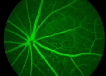 Retinal Scan