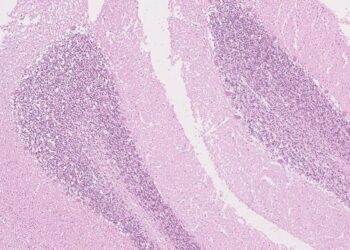 Histological image of cerbellum sample