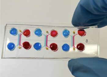 A gut-on-a-chip incorporating human faecal samples and peristalsis predicts responses to immune checkpoint inhibitors for melanoma
