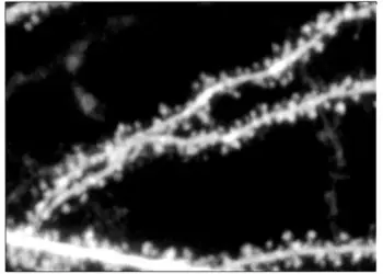 Dendritic spines