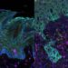 Oral Epithelial Cells