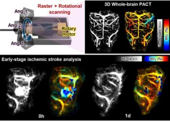 Visualization of the entire cerebrovascular structure and observation of acute ischemic stroke lesions using PACT on the entire brain