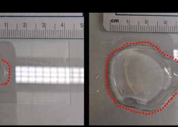 Hydrogel