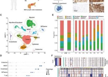 Identification of main cell populations in pancreatic ductal adenocarcinoma (PDAC).
