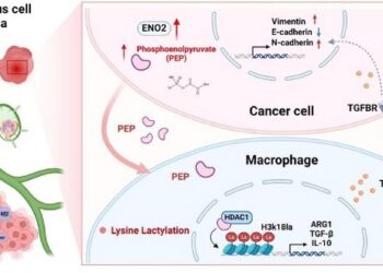 Model of tumor cell-derived ENO2 promoting macrophage M2 polarization and facilitating metastasis in HNSCC.