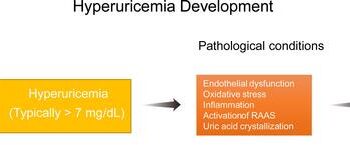 Hyperuricemia: Current State and Prospects