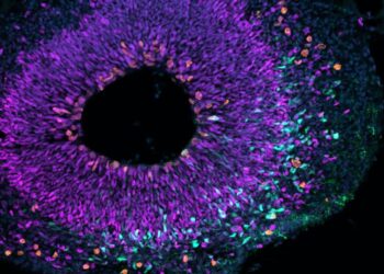 Chimpanzee brain organoid