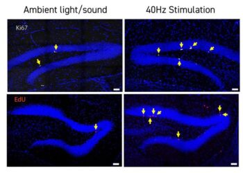 Neurogenesis with GENUS