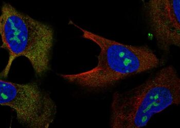 Human U2OS cell