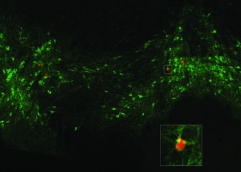 Dopamine source