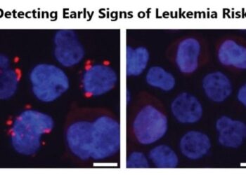 A link between aging, gut bacteria and leukemia risk