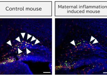 In neonatal mice exposed to maternal inflammation, the proportion of CD11c-positive microglia (yellow) was reduced compared to control mice