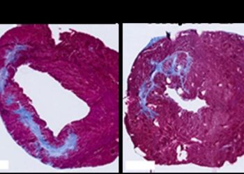 Treated tissue vs untreated tissue