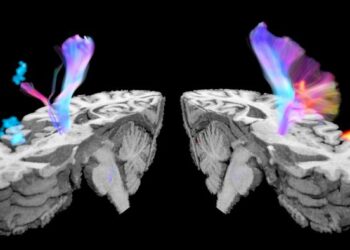 Brain visualization