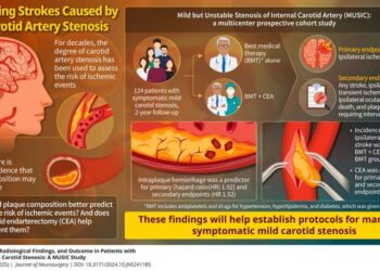 A prospective multicenter study on mild carotid artery stenosis