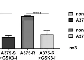 GSK3β activation is a key driver of resistance to Raf inhibition in BRAF mutant melanoma cells