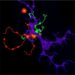miR-23/24/27 Cluster Targets GSK3β in Breast Cancer
