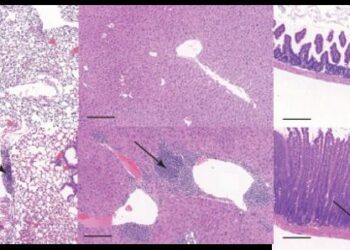Representative images of sections of the lung, liver, and small intestine from wild type and knockout mice