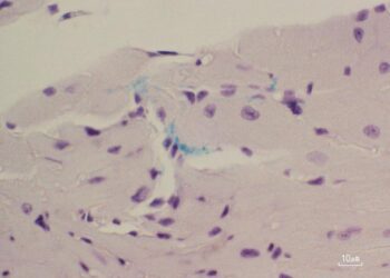 Immunohistochemical staining of the mouse left atrium