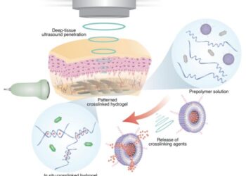 3D Printing In VIvo Using Sound