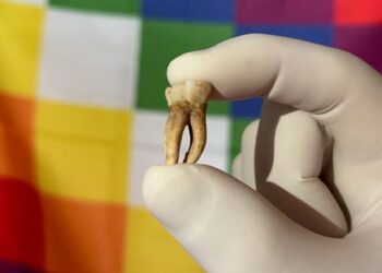 Archaeological tooth from human remains in South America.