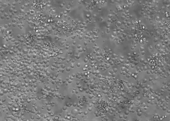 Mouse hematopoietic stem cells, day 12 of culture (10x magnification)