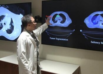 Study author Troy Teo shows how the AI tool contours a lung tumor as it moves with each breath