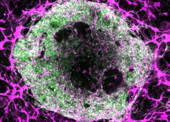 Heart organoid