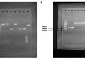 Integrating molecular diagnostics for early prostate cancer detection