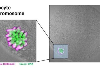 Localization of chromosomes and the distribution of the histone modification H3K4me3 in mouse oocytes