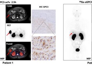 68Ga-XH06 PET/MR Images