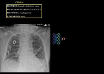 Video animation showing how the AI tool works
