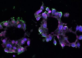 TNBC organoid