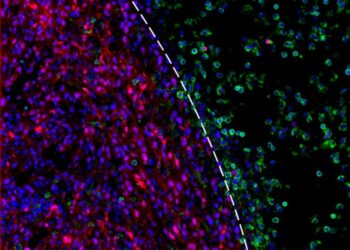 CD45 immune cells (green) are unable to penetrate the tumor bed (red).