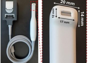 Toothbrush-shaped ultrasound allows for gum monitoring