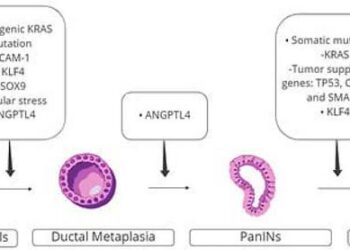 Pancreatic cancer pathways