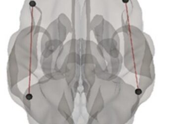 Brain stimulation can boost math learning in people with weaker neural connections