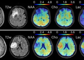 Metabolic MRI