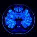 New Software Simplifies Amyloid PET Quantification Process