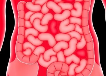 AI Advances in Necrotizing Enterocolitis: Challenges Ahead