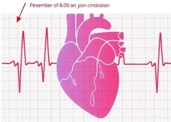 Exploring the Impact of Finerenone on Atrial Fibrillation in Heart Failure Patients