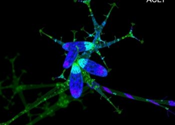 Glucose Controls Oligodendrocyte Growth via ACLY Acetylation — Medicine