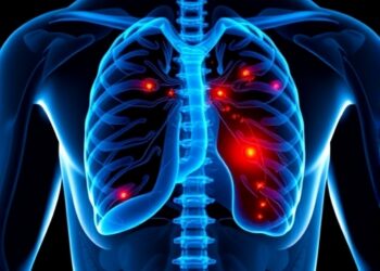 Long Term PSA Screening Improves Prostate Outcomes