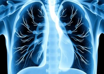 Multi View Deep Learning Detects Pediatric Pulmonary TB