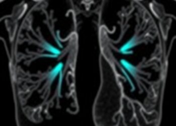 New Study Shows Lung Scans Uncover Key Differences in Sarcoidosis Severity — Medicine