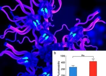 RBM14 Boosts Prostate Cancer by Enhancing Glycolysis — Medicine