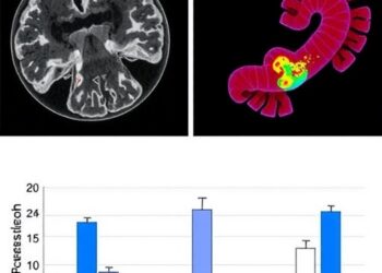 Raised Colonic IL-1β and IL-8 in REM Sleep Disorder — Medicine