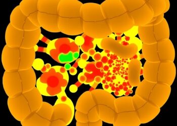 Spatial Clues Guide Chemo-Immunotherapy in Colorectal Cancer — Medicine