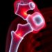 AI-Driven Nonlinear Optical Imaging Detects Protein Spatial Homogenization Linked to Reduced Bone Quality in Type 2 Diabetes — Technology and Engineering
