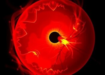 AI Model Predicts Risk Post-Radical Nephrectomy — Medicine
